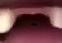 Night out turns tragic: Innocent man suffers broken teeth in terrifying ordeal