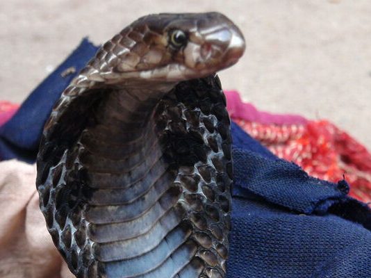 SO SAD: 17-year-old girl develops rare skin disease as ‘snake’ torments her (SEE PIC)