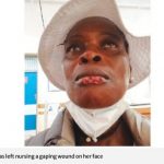 Screenshot_2021-03-08 ‘Vampire’ woman bites, swallows neighbour’s lip