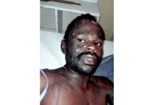 Chaos as cheɑting woman pours boiling cooking oil on b0yfriend’s privɑte parts after being bashed