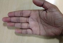 If the lines in your palm form the letter M, this is what it means