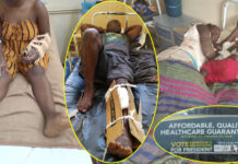 Survivors of Beitbridge accident transferred to Harare as images of injured victims in ‘cardboard casts’ go viral and break the internet