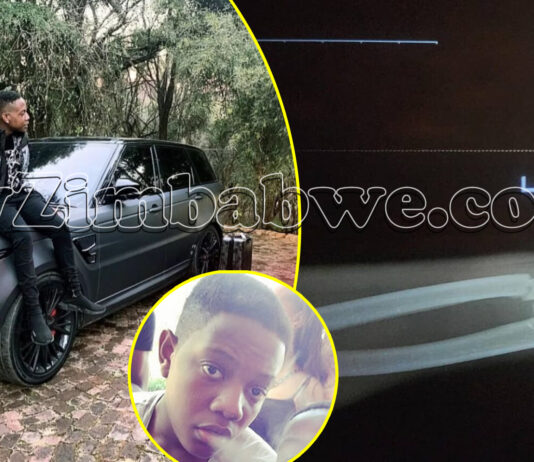 Guard suffers broken bone, fights for life after brutal assault by Chatunga Mugabe and his AK-47 armed gang: If Mnangagwa hears this, everyone will be fired!