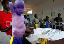 Chiredzi family seeks US$210 donation for a life-changing surgery: Their 4-year-old son defecates through the stomach