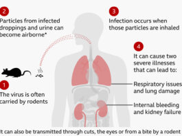 Hantavirus panic hits Zimbabwe: 3 health workers now under strict quarantine… Was the public told the WHOLE truth?