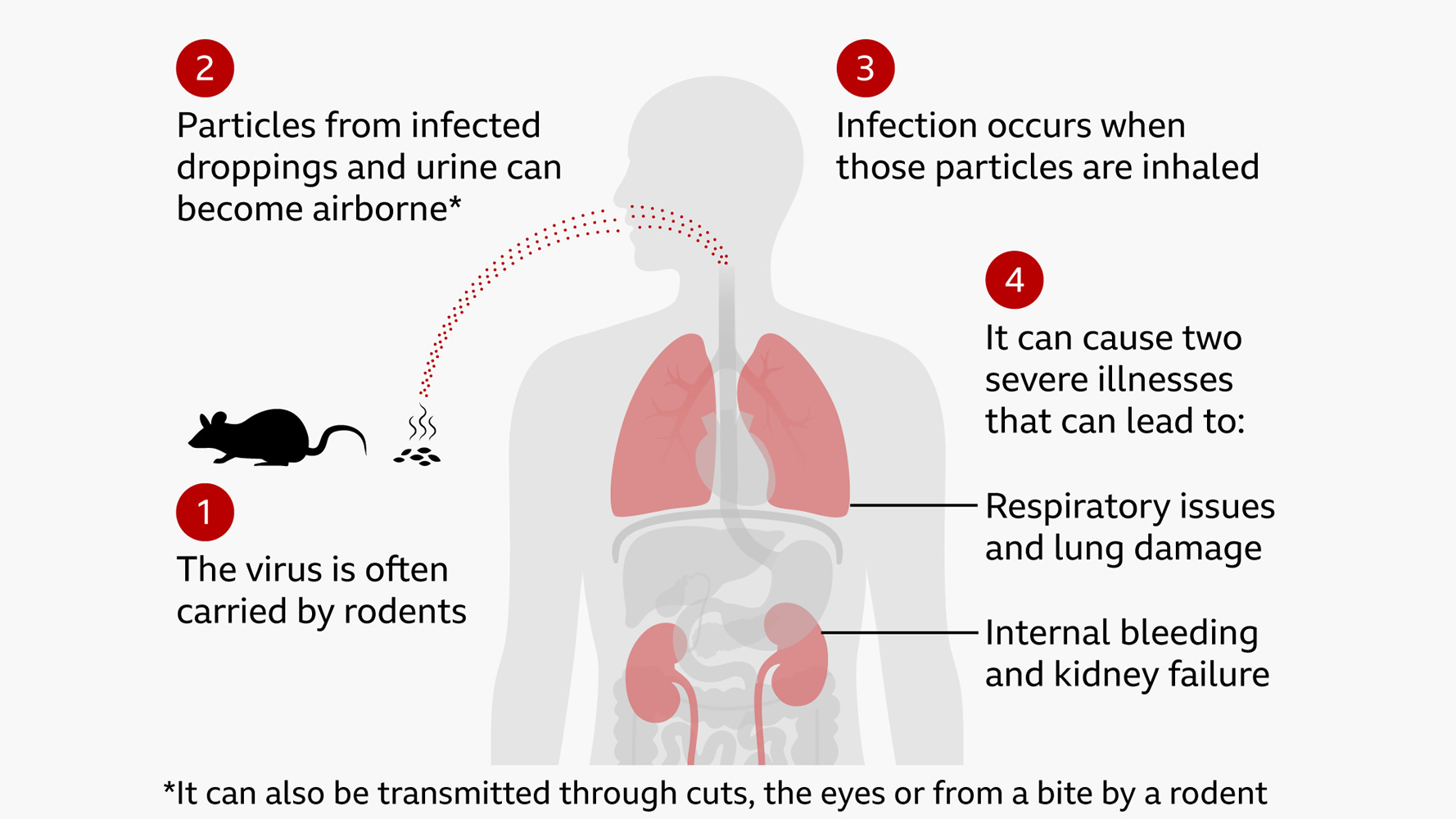 Hantavirus panic hits Zimbabwe: 3 health workers now under strict quarantine… Was the public told the WHOLE truth?
