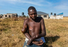 Stealing fish in Lake Chivero ends in tears: Norton man now disabled after fighting with a deadly crocodile for 30 minutes