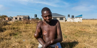 Stealing fish in Lake Chivero ends in tears: Norton man now disabled after fighting with a deadly crocodile for 30 minutes