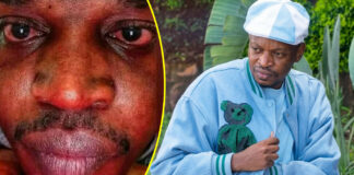 Seh Calaz speaks out after suffering from the deadly sickness that almost killed him: “I thought I was about to die”