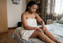 Scabies rash outbreak hits Harare, especially in the following suburbs